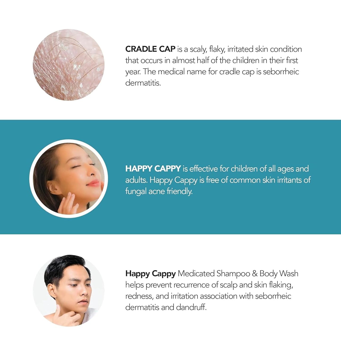 Happy Cappy Medicated Shampoo and Body Wash- Baby Dandruff Shampoo, Helps Cradle Cap and Seborrheic Dermatitis, Reduces Flakes and Redness, Dermatologist Tested, Fragrance-Free - 8 Fl Oz