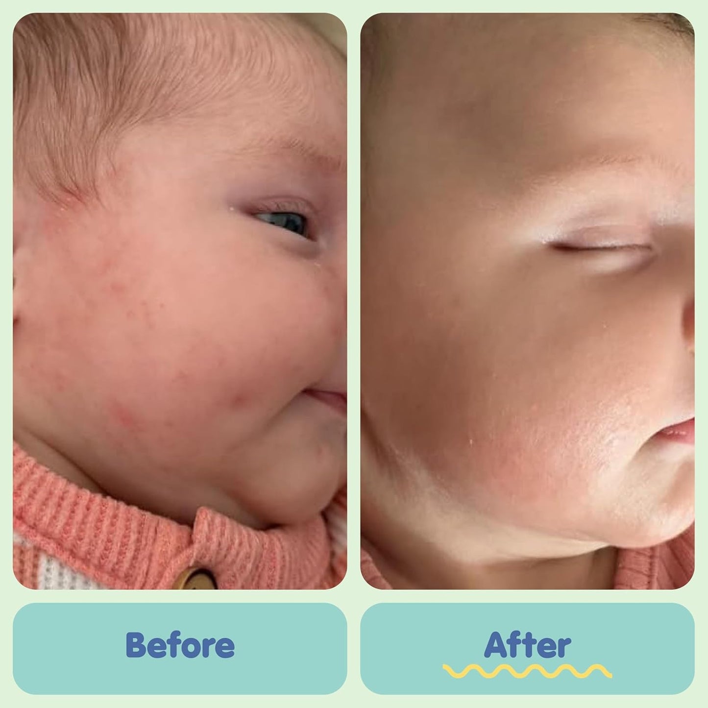 TUBBY TODD All Over Ointment - Baby Eczema Cream - Everyday Multi-Purpose Baby Skin Relief Cream - Sensitive Skin, Dry Skin, Rash, & Irritation - Steroid & Gluten Free - Lavender Rosemary, 2 Pack, 8oz