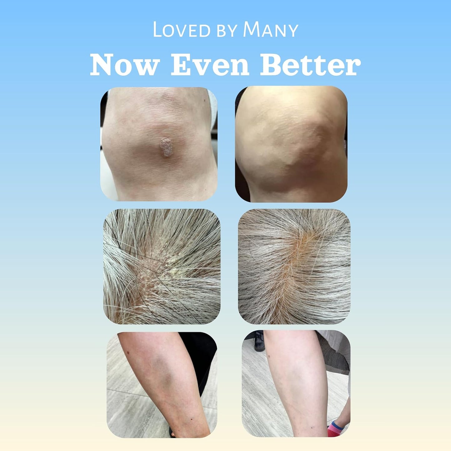 Natural SKIN REPAIR Clinically tested Aromatherapy. Powerful Herbal Essential Oil Soothing Multi-purpose Skin Care Eczema, Dermatitis, Diaper rash, and Sensitive skin. (Green tube 50ml)