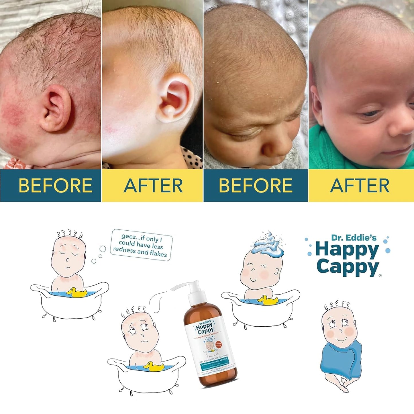 Happy Cappy Medicated Shampoo and Body Wash- Baby Dandruff Shampoo, Helps Cradle Cap and Seborrheic Dermatitis, Reduces Redness, Dermatologist Tested, Fragrance-Free- 8 Fl Oz (Pack of 4)
