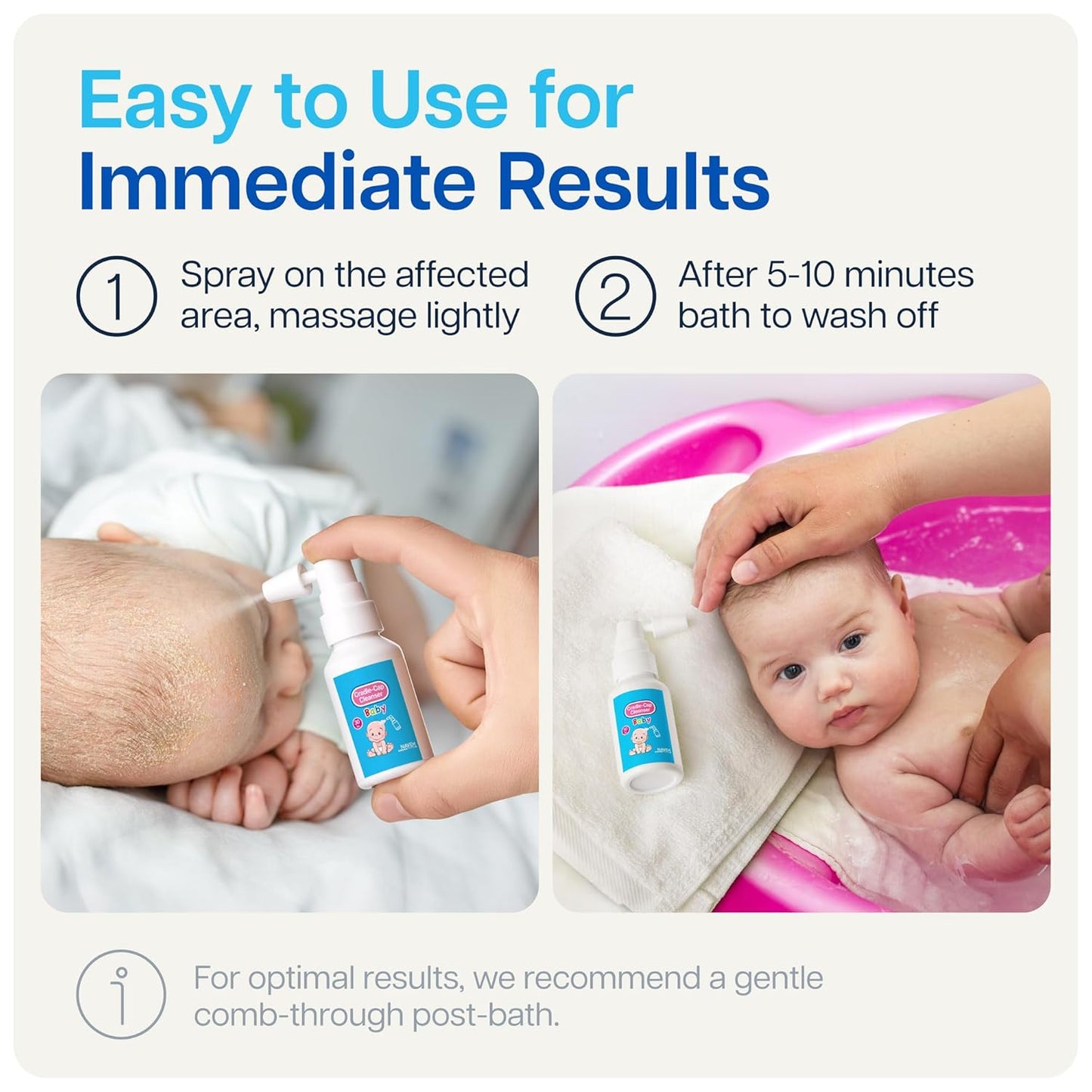 NAVEH PHARMA Cradle Cap Cleanser For Baby & Kids | 100% Natural Cradle Cap Treatment | Spray & Wash No Scrubbing | Better Than Shampoo Or Brush | Help With Dandruff | Olive Oil & Squalane | 1 FL OZ